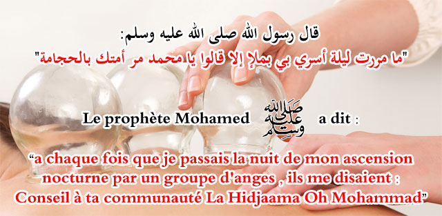 slide_hadith_hijama333